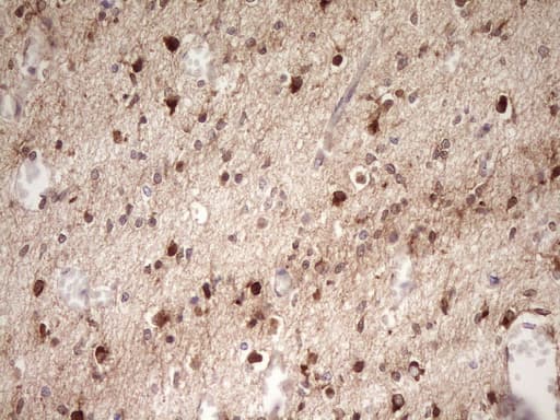 FARSB Antibody (clone OTI4B3)