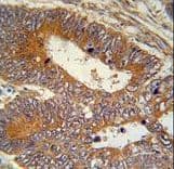 MAP1S Antibody (aa493-520)
