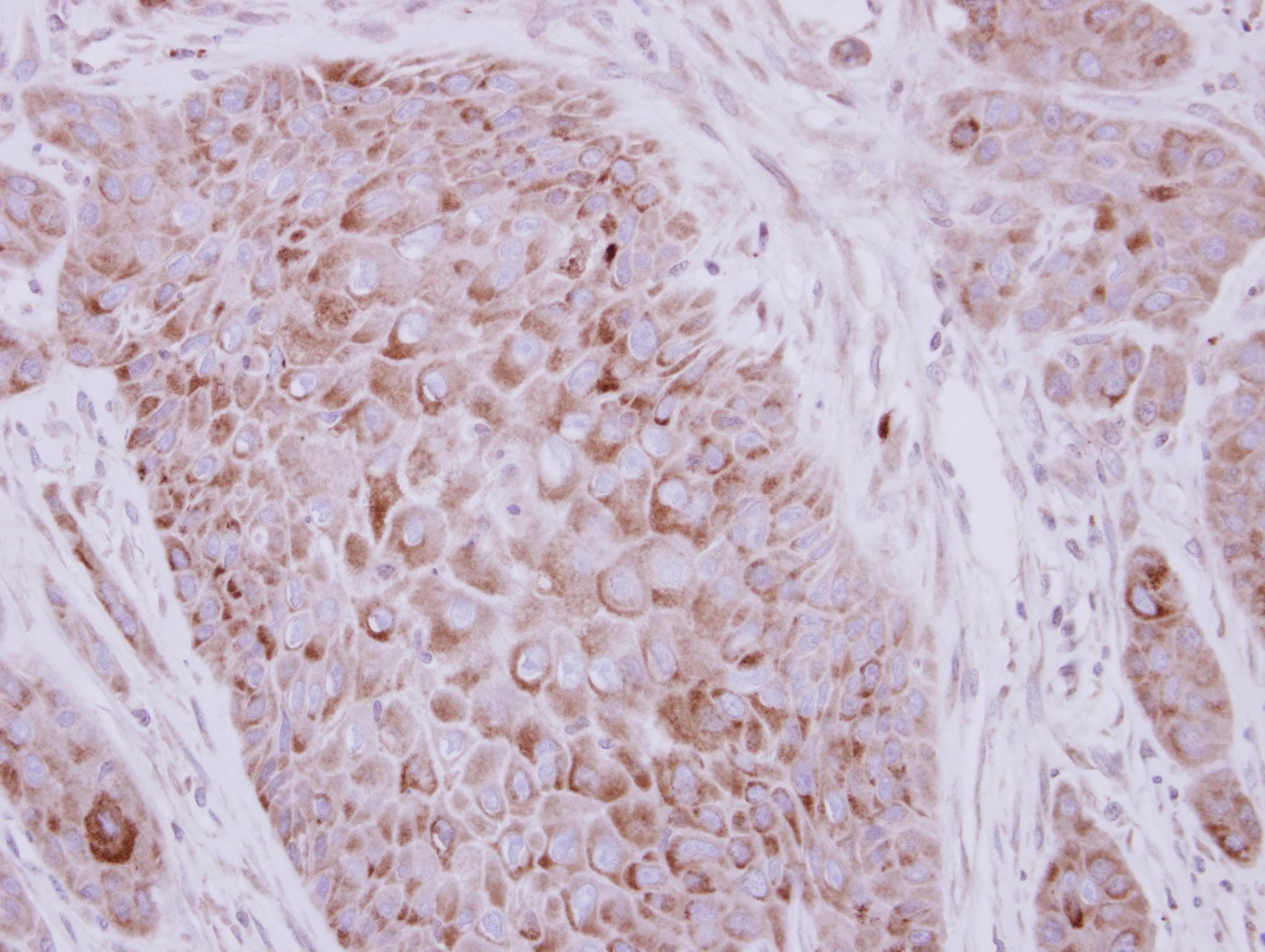 ZP2 Antibody