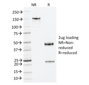 Monoclonal Mouse anti-Human NPM1 / NPM / Nucleophosmin Antibody (clone NA24, Azide-free,BSA-free, IHC)