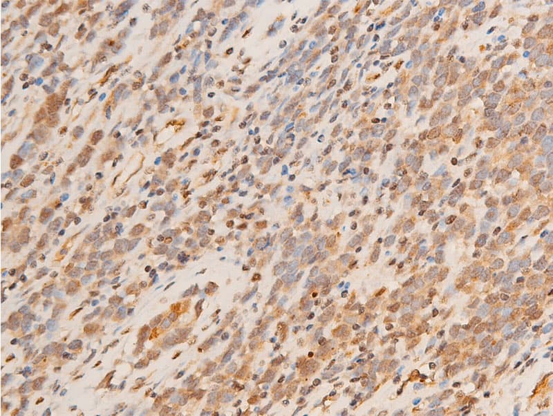 SGK1 / SGK Antibody (phospho-Ser422)