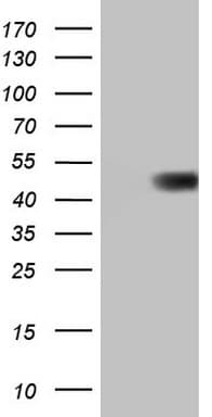 PathPlus™ PDCD1 / CD279 / PD-1 Antibody (clone 11B2)