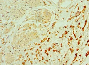 TAC1 Antibody (aa1-129)