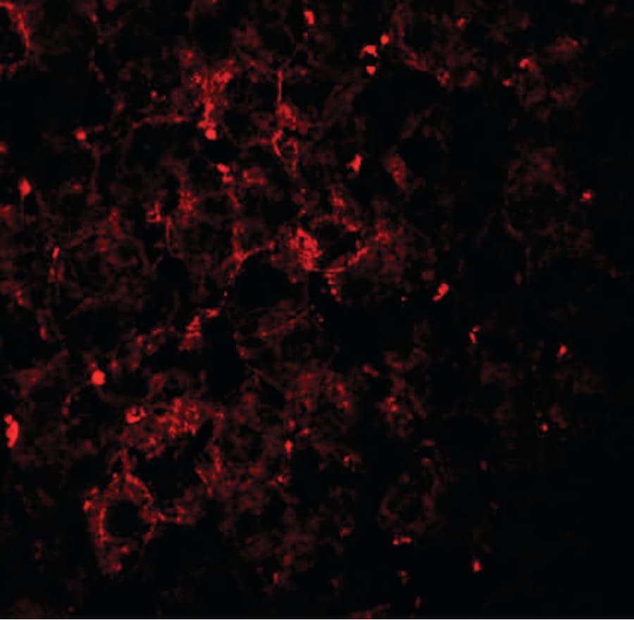 IHC-plus™ Polyclonal Rabbit anti-Human VPS39 Antibody (IHC, IF, WB)