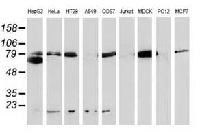 CTNNB1 / Beta Catenin Antibody (clone OTI1E10, Carrier-free)
