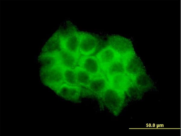DVL3 / Dishevelled 3 Antibody (clone 4H2)