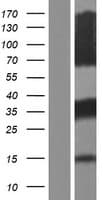 FHL5 Protein (Over-Expression Lysate Myc-DDK (Flag))