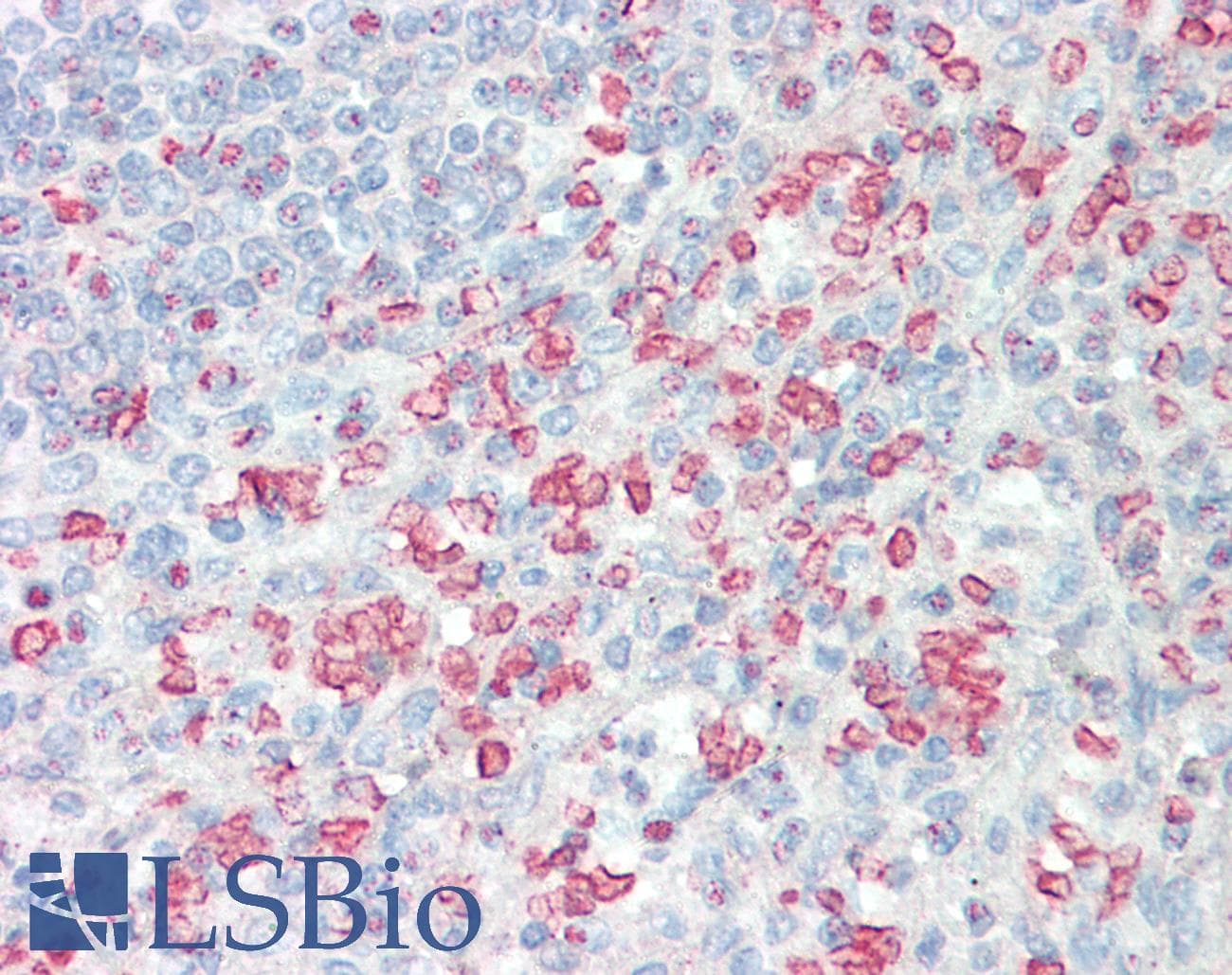 IHC-plus™ IPMK Antibody (aa311-360)