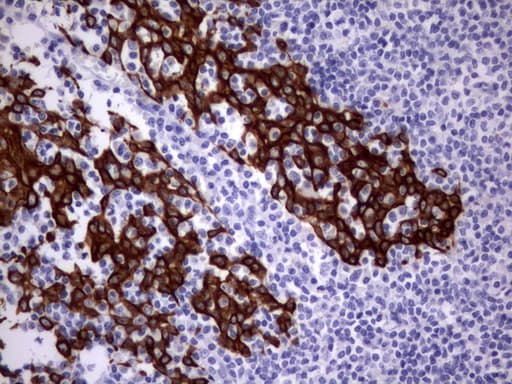 Acidic Cytokeratin Antibody (clone 8F5)