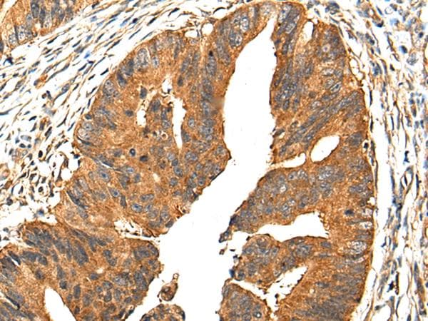 Polyclonal Rabbit anti-Human PIBF1 / PIBF Antibody (IHC, WB)