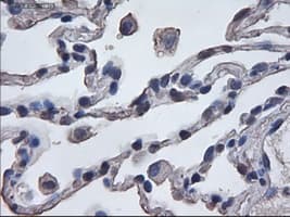 MAPK6 / ERK3 Antibody (clone OTI1A9)