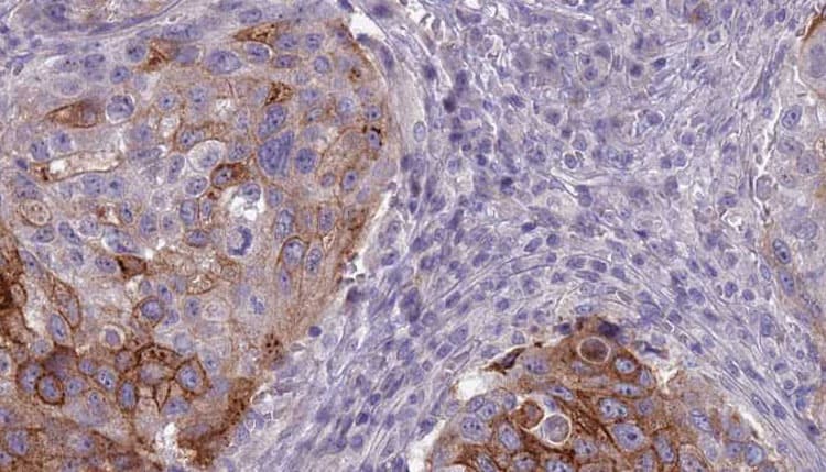 ADGRB1 / BAI1 Antibody