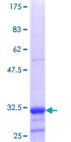 Human URAT1 / SLC22A12 Protein (Recombinant GST, N-terminus)