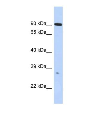 Polyclonal Rabbit anti-Human ADAM23 Antibody (aa71-120, WB)