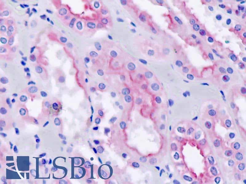 IHC-plus™ Polyclonal Rabbit anti-Human RAB4B Antibody (aa29-58, IHC, WB)