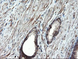 PSMA6 Antibody (clone OTI3B8)