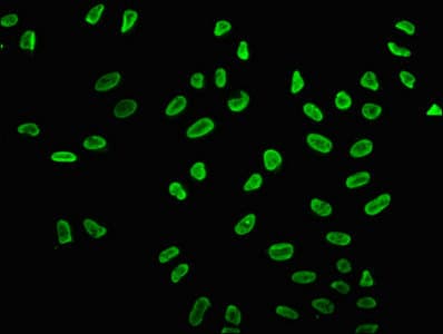 HIST1H2BN Antibody