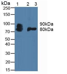 CSF3R / CD114 Antibody (aa271-428)