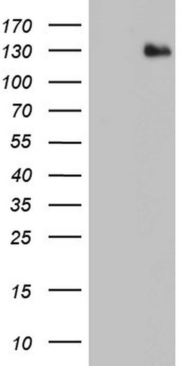Monoclonal Mouse anti-Human ADAMTS1 Antibody (clone OTI4H2, aa412-644, WB)