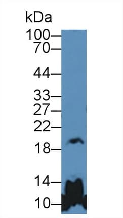 PathPlus™ GH / Growth Hormone Antibody (aa28-217)