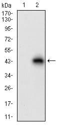 ACP5 / TRAP Antibody (aa221-325, clone 7E6A11)