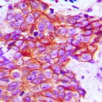 CLDN5 / Claudin 5 Antibody (C-Terminus)