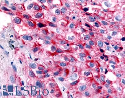 PathPlus™ GPR32 Antibody (Extracellular Domain)