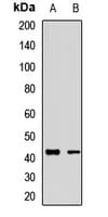 KCNK9 / TASK3 Antibody