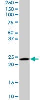 RAB6A / RAB6 Antibody (clone 3G3)