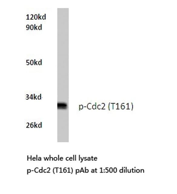 Polyclonal Rabbit anti-Human CDK1 / CDC2 Antibody (phospho-Thr161, IHC, WB)