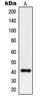 PGA5 / Pepsin A Antibody (Internal)