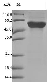 Human FGB / Fibrinogen Beta Chain Protein (Recombinant 6His, N-terminus)