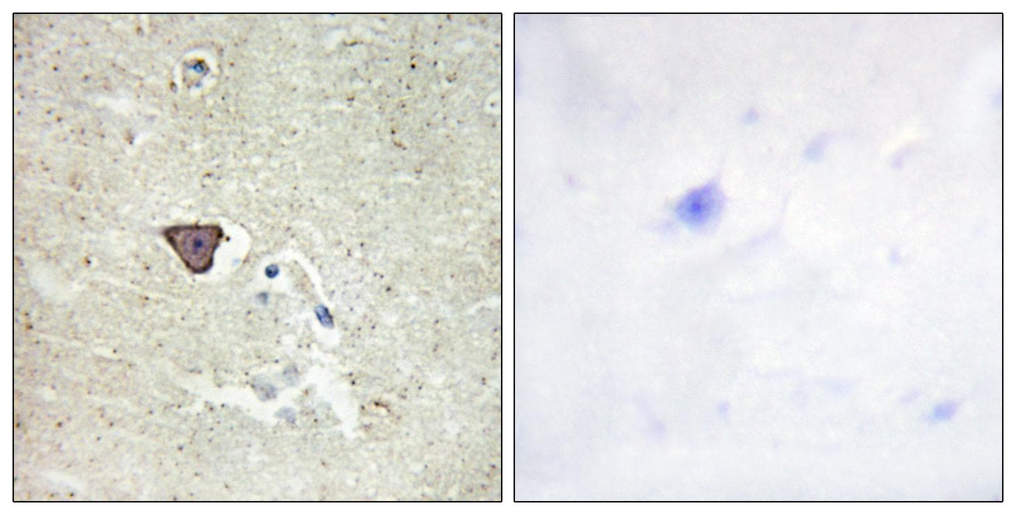 Polyclonal Rabbit anti-Human CDH9 / Cadherin 9 Antibody (IHC, IF, WB)