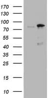 NBN / Nibrin Antibody (aa183-460, clone OTI3C12, Carrier-free)
