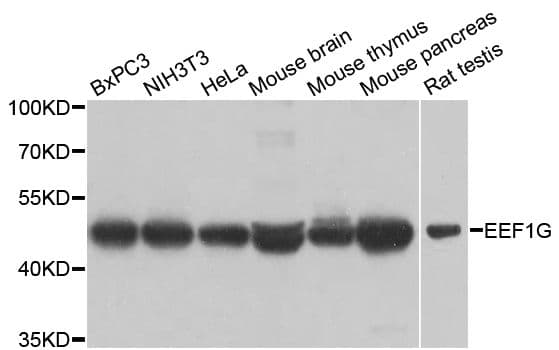 EF1G / EEF1G Antibody