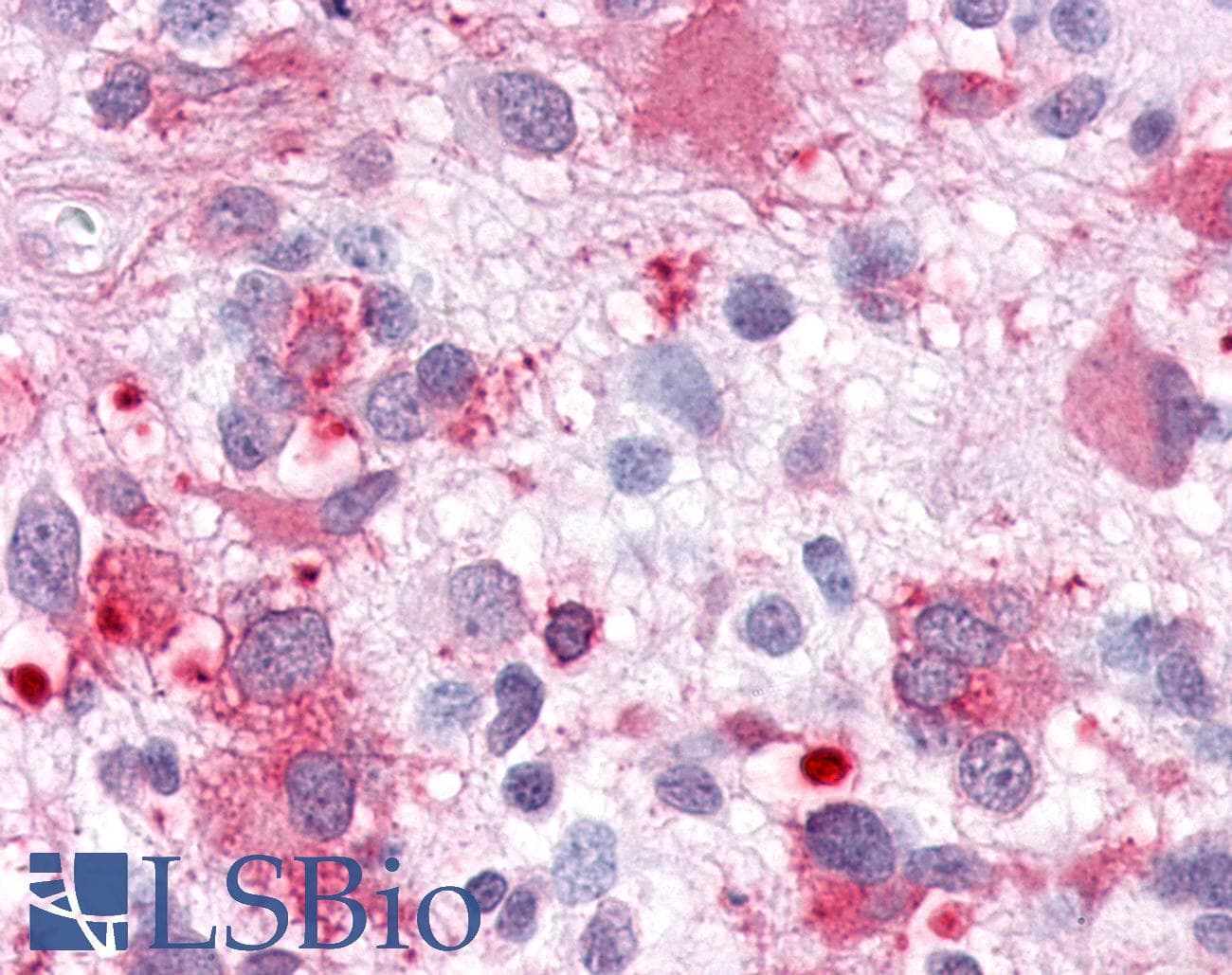PathPlus™ GPR63 Antibody (C-Terminus)