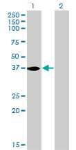 IHC-plus™ NMI Antibody (clone 9D8)