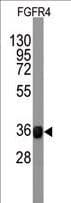 IHC-plus™ FGFR4 Antibody (clone 53CT32.19.3)