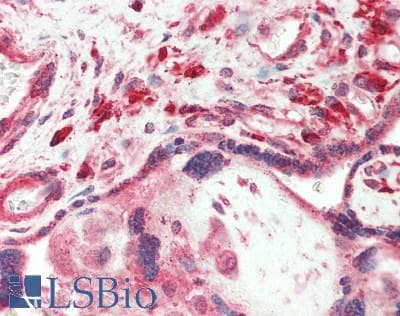 IHC-plus™ Polyclonal Rabbit anti-Human MBOAT5 / C3F Antibody (IHC)