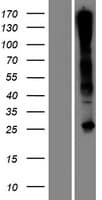 C17orf77 Protein (Over-Expression Lysate Myc-DDK (Flag))