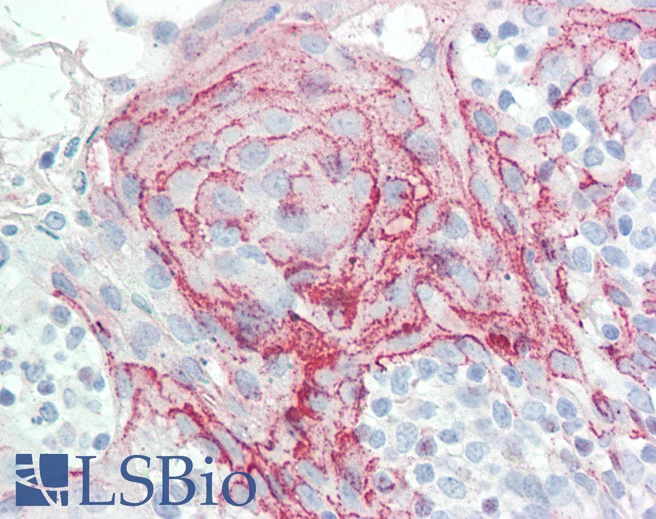 IHC-plus™ Polyclonal Goat anti-Human HOXC6 Antibody (aa22-36, IHC, WB)