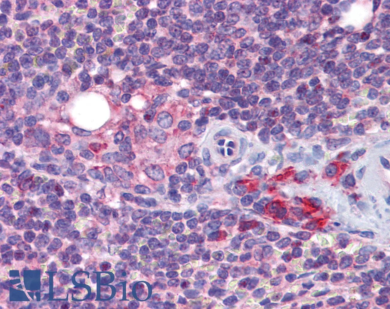 IHC-plus™ KDM4A / JHDM3A / JMJD2A Antibody