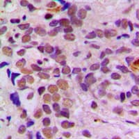 ATF1 Antibody (C-Terminus)
