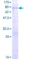 Human PAK1IP1 / HPIP1 Protein (Recombinant GST)