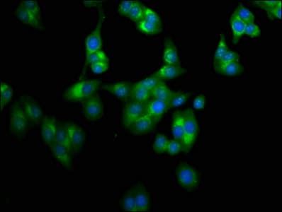 LAPTM4A Antibody
