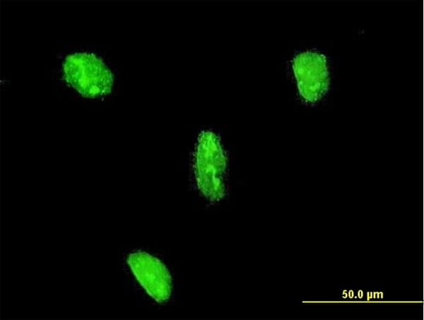 LHX3 Antibody (clone 2C10)