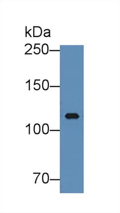 ITIH3 Antibody (aa279-467)