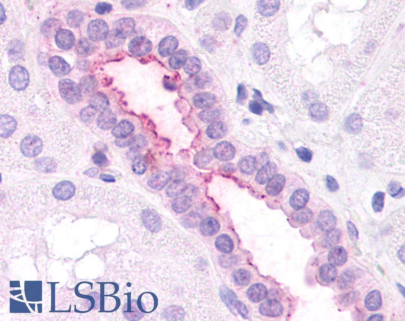 IHC-plus™ CXCR2 Antibody (N-Terminus)