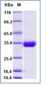 Human IL2RB / CD122 Protein (Recombinant His,C-terminus)