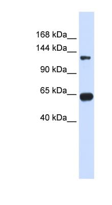 RGS22 Antibody (aa216-265)